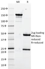 CD106/VCAM1 (Activated Endothelial Cell Marker) Antibody in SDS-PAGE (SDS-PAGE)