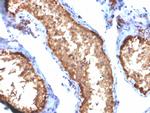 Vinculin Antibody in Immunohistochemistry (Paraffin) (IHC (P))