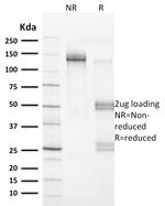 Vinculin Antibody in SDS-PAGE (SDS-PAGE)