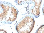 Vinculin (Marker of Age-related Macular Degeneration) Antibody in Immunohistochemistry (Paraffin) (IHC (P))