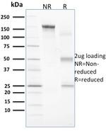 Vinculin (Marker of Age-related Macular Degeneration) Antibody in SDS-PAGE (SDS-PAGE)