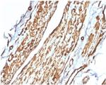 Vinculin (Marker of Age-related Macular Degeneration) Antibody in Immunohistochemistry (Paraffin) (IHC (P))