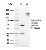 Vinculin (Marker of Age-related Macular Degeneration) Antibody in SDS-PAGE (SDS-PAGE)