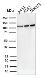 Vinculin (Marker of Age-related Macular Degeneration) Antibody in Western Blot (WB)