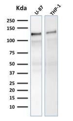 Vinculin (Marker of Age-related Macular Degeneration) Antibody in Western Blot (WB)