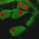 Vinculin Antibody in Immunocytochemistry (ICC/IF)