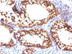 Vinculin Antibody in Immunohistochemistry (Paraffin) (IHC (P))