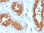 Vinculin Antibody in Immunohistochemistry (Paraffin) (IHC (P))