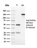 Vinculin Antibody in SDS-PAGE (SDS-PAGE)