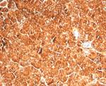 Vinculin (Marker of Age-related Macular Degeneration) Antibody in Immunohistochemistry (Paraffin) (IHC (P))