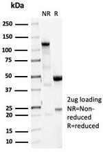 Vinculin (Marker of Age-related Macular Degeneration) Antibody in SDS-PAGE (SDS-PAGE)