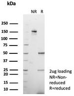 Vinculin (Marker of Age-related Macular Degeneration) Antibody in SDS-PAGE (SDS-PAGE)