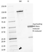 VEGF (Vascular Endothelial Growth Factor) Antibody in SDS-PAGE (SDS-PAGE)