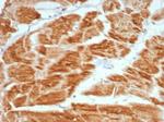 VEGF (Vascular Endothelial Growth Factor) Antibody in Immunohistochemistry (Paraffin) (IHC (P))