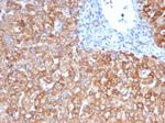 VEGF (Vascular Endothelial Growth Factor) Antibody in Immunohistochemistry (Paraffin) (IHC (P))