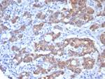 Villin (GI-Mucosal and Urogenital Brush Border Marker) Antibody in Immunohistochemistry (Paraffin) (IHC (P))