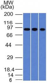 Villin (GI-Mucosal and Urogenital Brush Border Marker) Antibody in Western Blot (WB)