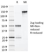 Villin (GI-Mucosal and Urogenital Brush Border Marker) Antibody in SDS-PAGE (SDS-PAGE)