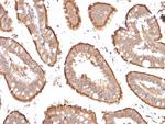 Villin (GI-Mucosal and Urogenital Brush Border Marker) Antibody in Immunohistochemistry (Paraffin) (IHC (P))