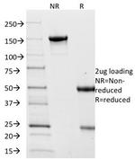 Villin (GI-Mucosal and Urogenital Brush Border Marker) Antibody in SDS-PAGE (SDS-PAGE)