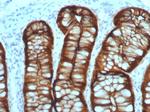 Villin (GI-Mucosal and Urogenital Brush Border Marker) Antibody in Immunohistochemistry (Paraffin) (IHC (P))