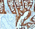 Villin (GI-Mucosal and Urogenital Brush Border Marker) Antibody in Immunohistochemistry (Paraffin) (IHC (P))