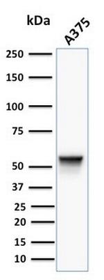 Vimentin (Mesenchymal Cell Marker) Antibody in Western Blot (WB)