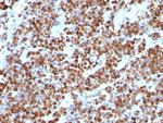 Vimentin (Mesenchymal Cell Marker) Antibody in Immunohistochemistry (Paraffin) (IHC (P))