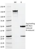 Vimentin (Mesenchymal Cell Marker) Antibody in SDS-PAGE (SDS-PAGE)