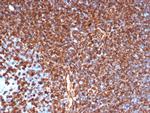 Vimentin (Mesenchymal Cell Marker) Antibody in Immunohistochemistry (Paraffin) (IHC (P))