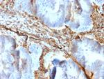 Vimentin (Mesenchymal Cell Marker) Antibody in Immunohistochemistry (Paraffin) (IHC (P))