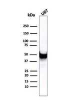 Vimentin (Mesenchymal Cell Marker) Antibody in Western Blot (WB)