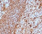 Vimentin (Mesenchymal Cell Marker) Antibody in Immunohistochemistry (Paraffin) (IHC (P))