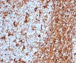 Vimentin (Mesenchymal Cell Marker) Antibody in Immunohistochemistry (Paraffin) (IHC (P))