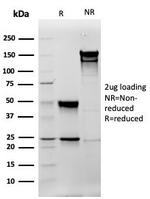 Vimentin (Mesenchymal Cell Marker) Antibody in SDS-PAGE (SDS-PAGE)