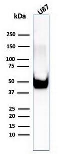 Vimentin (Mesenchymal Cell Marker) Antibody in Western Blot (WB)