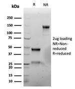 Vimentin (Mesenchymal Cell Marker) Antibody in Immunoelectrophoresis (IE)