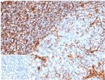 Vimentin (Mesenchymal Cell Marker) Antibody in Immunohistochemistry (Paraffin) (IHC (P))