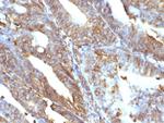 Vimentin (Mesenchymal Cell Marker) Antibody in Immunohistochemistry (Paraffin) (IHC (P))