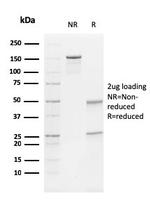 Vimentin (Mesenchymal Cell Marker) Antibody in SDS-PAGE (SDS-PAGE)