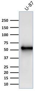 Vimentin (Mesenchymal Cell Marker) Antibody in Western Blot (WB)