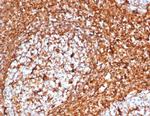 Vimentin (Mesenchymal Cell Marker) Antibody in Immunohistochemistry (Paraffin) (IHC (P))