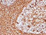 Vimentin (Mesenchymal Cell Marker) Antibody in Immunohistochemistry (Paraffin) (IHC (P))