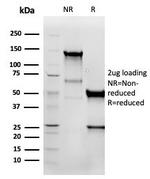 Vimentin (Mesenchymal Cell Marker) Antibody in SDS-PAGE (SDS-PAGE)