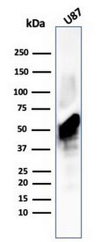 Vimentin (Mesenchymal Cell Marker) Antibody in Western Blot (WB)