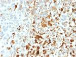 Vimentin (Mesenchymal Cell Marker) Antibody in Immunohistochemistry (Paraffin) (IHC (P))