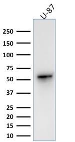 Vimentin (Mesenchymal Cell Marker) Antibody in Western Blot (WB)