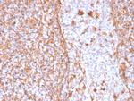 Vimentin (Mesenchymal Cell Marker) Antibody in Immunohistochemistry (Paraffin) (IHC (P))