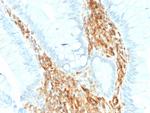 Vimentin (Mesenchymal Cell Marker) Antibody in Immunohistochemistry (Paraffin) (IHC (P))