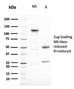 Vimentin (Mesenchymal Cell Marker) Antibody in SDS-PAGE (SDS-PAGE)